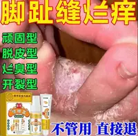 香港喷䐚王腳脱皮腳殠腳痒出汗起水泡止痒抑菌止痒一喷一抹