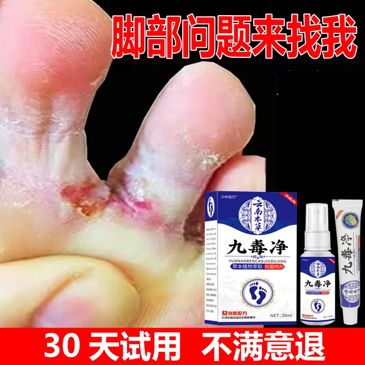 脚止痒灵脚臭脚汗脚痒脚脱皮干裂起水泡脚趾缝克星专用抑菌喷雾