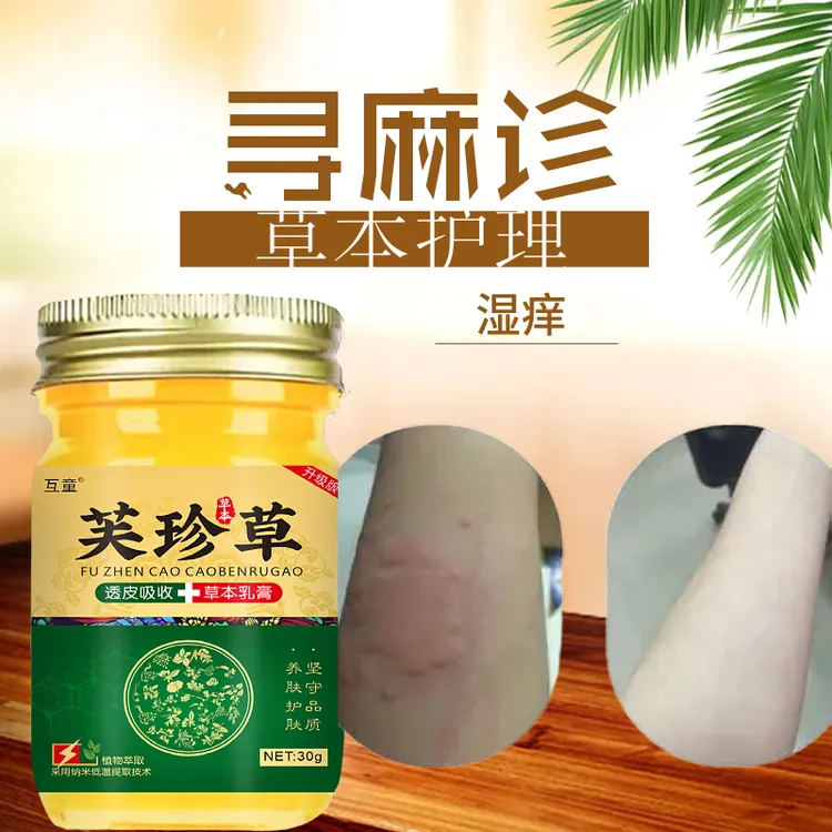 荨麻红点点手臂上疹湿痒腿部痒草本必备腿部抓疙瘩吹风起疙瘩红斑