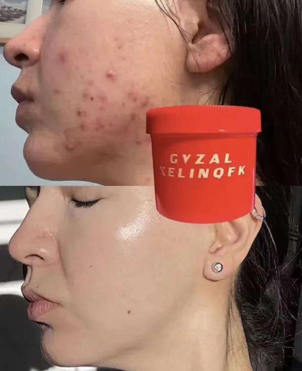 Guzal kelinqak全身美白霜