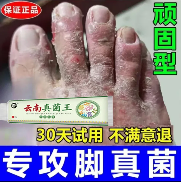 【官方正品】真菌王手足护理膏植物草本温和脚脱皮开裂草本抑菌乳膏
