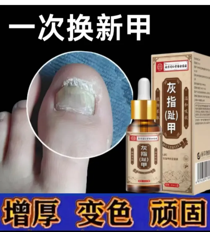 南京同仁堂草本灰趾指甲专用特效药正品根治特效专用抑菌液亮甲液