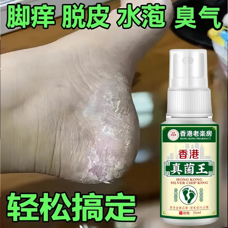 正品真菌王脚痒脚臭起水泡脚缝痒脱皮香港脚脚底痒抑菌止痒喷雾剂