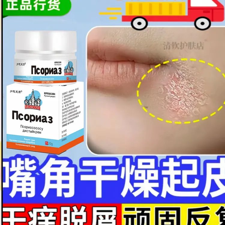 脸上起皮红痒面部嘴角下巴鼻子两侧干燥长鲜有碎屑脂溢性皮肤焱膏