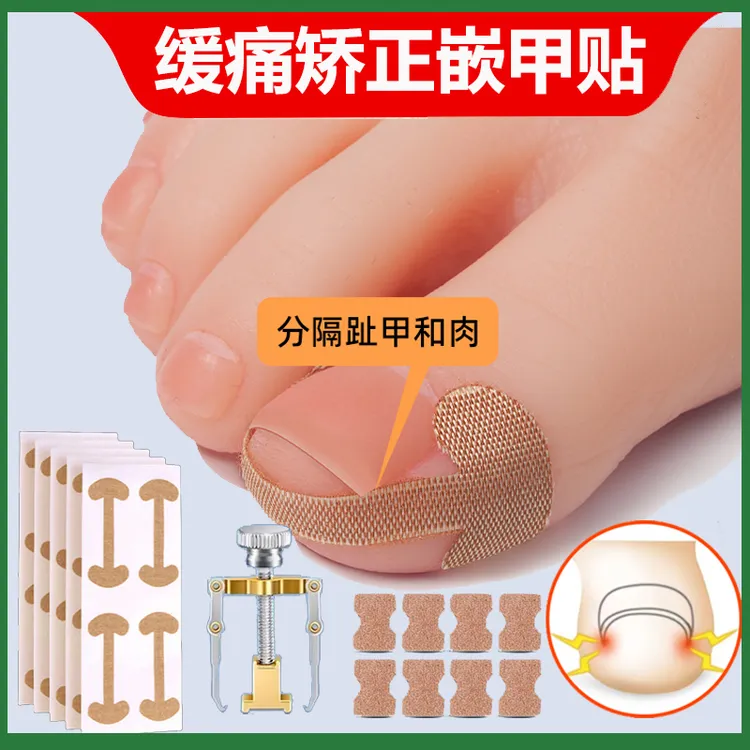 甲沟炎矫正神器嵌甲矫正器指甲扎肉脚指甲往肉里长专用正甲贴垫片
