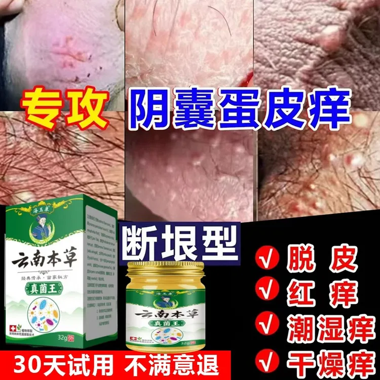 男人私处蛋蛋痒阴部潮湿下体大腿内侧痒起乌龟皮疙瘩痒抑菌止痒膏