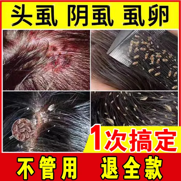 虱立净虱子儿童通用去头虱虱子虱虫虱卵虮子一扫光正品本草喷剂