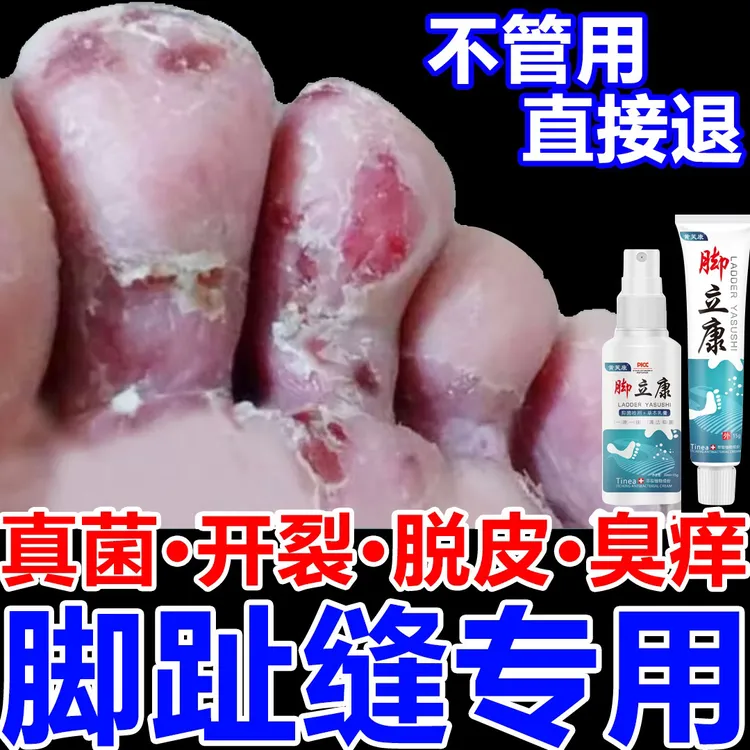 脚趾缝臭痒专用抑菌止痒膏脚痒真菌干裂脱皮汗脚克星水泡喷雾剂