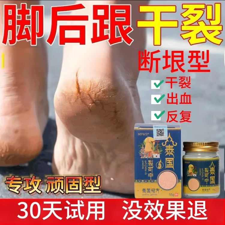 裂可宁脚后跟开裂秋冬季神器防裂膏手足干裂痒抑菌感染护理止痒膏