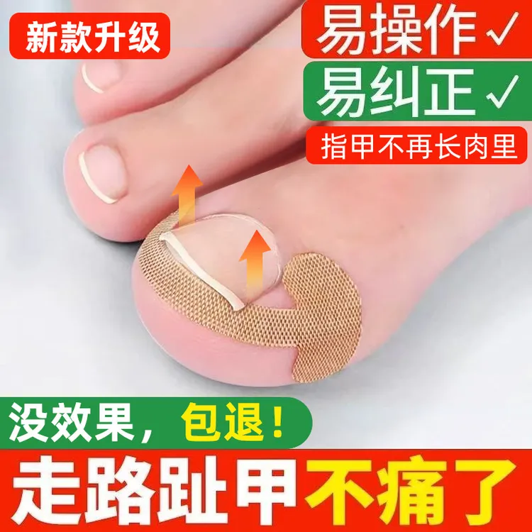 甲沟矫正器嵌甲往肉里长专用隔离贴片纠正家用神器脚趾甲垫灰贴炎