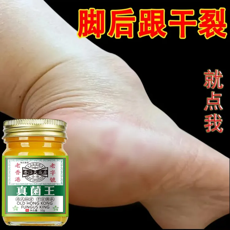 香港真菌王脚后跟开裂秋冬季神器防裂膏手足干裂痒真菌感染抑菌膏