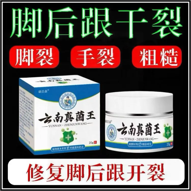 云南真菌王脚后跟干裂起硬皮真1菌1感染脱皮干裂修复膏