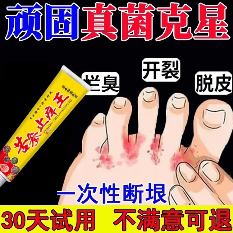 真菌王手脚脚痒脚臭止痒膏脚趾缝烂痒脱皮抑菌开裂克星痒专用软膏