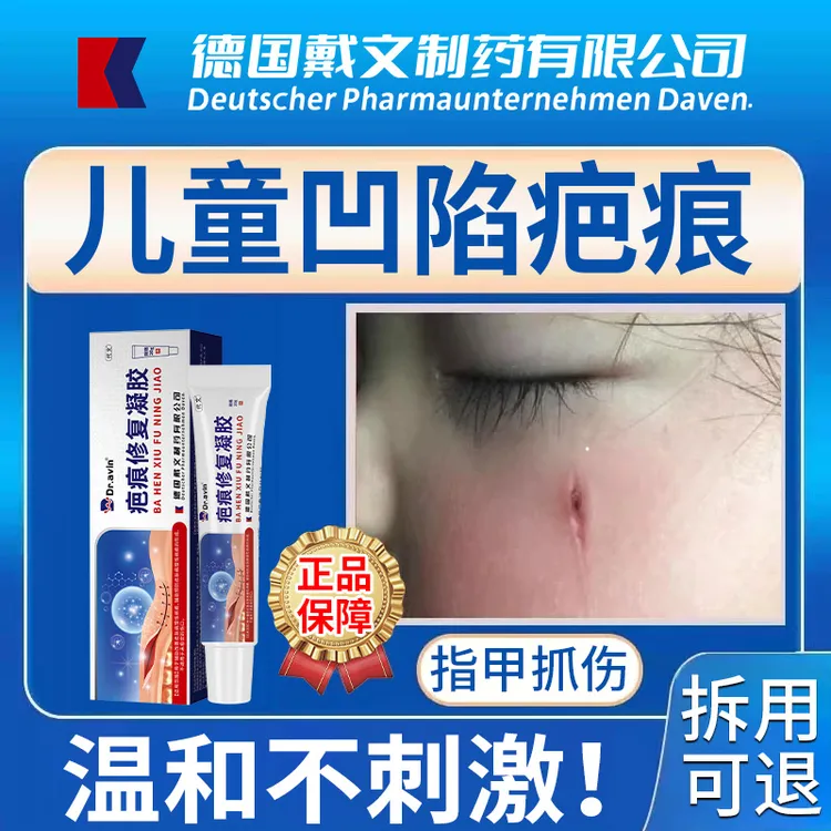 代文指甲抓伤凹陷疤痕修复膏改善皮肤病理性疤痕预防疤痕形成疤痕修复凝胶