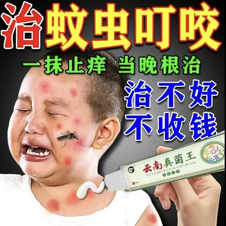 云南真菌王蚊虫叮咬止痒消肿婴儿童宝宝成人臭虫跳蚤咬专用药膏