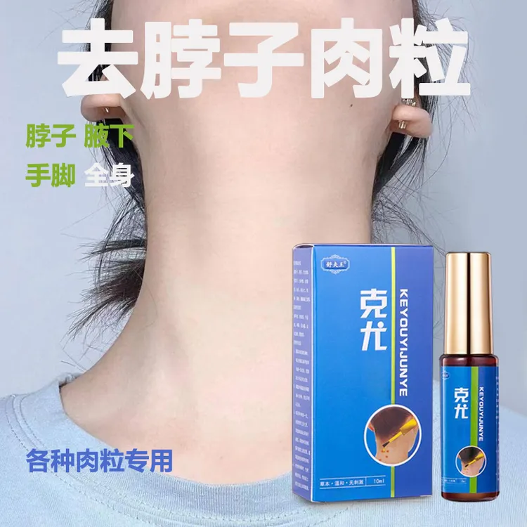 【小肉粒专用】舒夫王正品克尤液脖子手足腋下丝状扁平肉刺草本温和