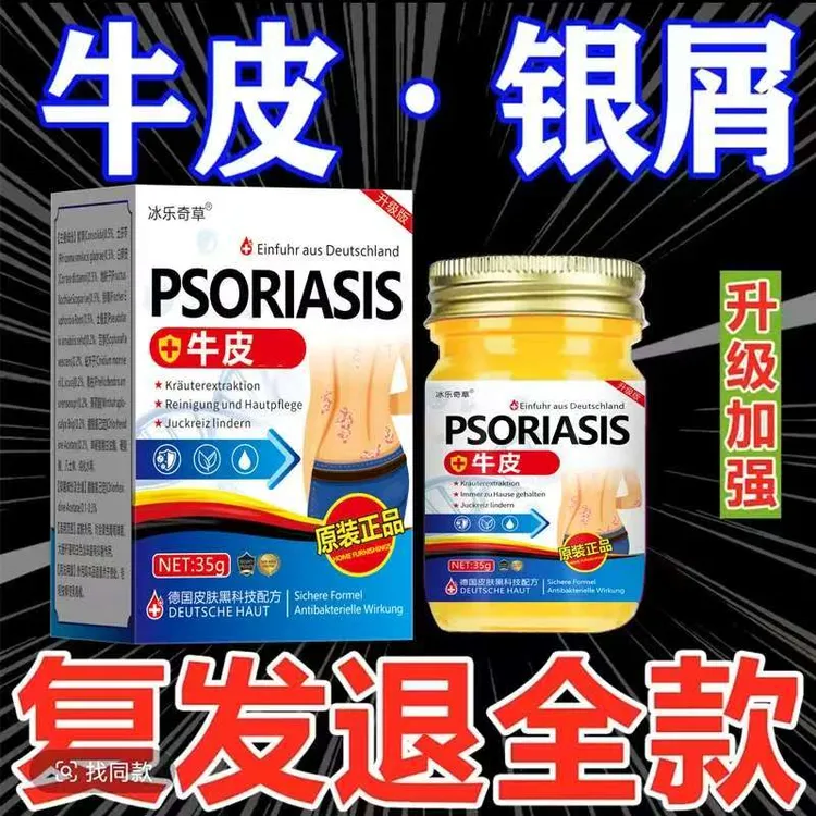 【德国牛皮膏】全身牛/皮/银/屑/鲜/手足头体/股大腿内侧草本止痒膏