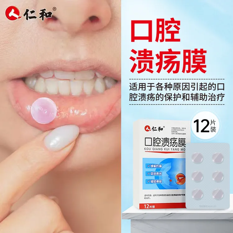 仁和口腔溃疡膜口腔溃疡专用贴口疮贴片嘴巴嘴唇溃疡起泡贴儿童成人通用12片/盒