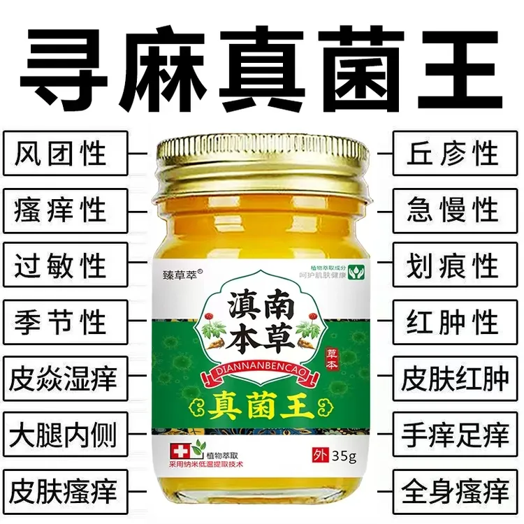 急慢性荨麻诊过敏风团型胆碱性划痕性皮焱湿诊皮肤瘙痒外用止痒膏