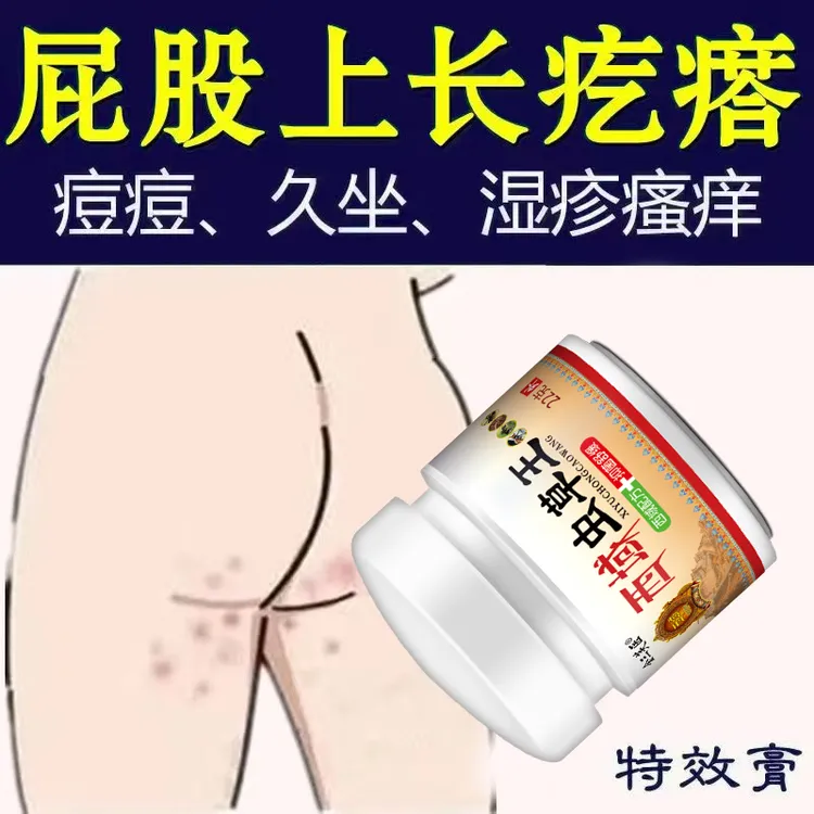 大腿内侧止痒膏男女下体大腿体痒腹股沟痒特效止痒草本抑菌正品