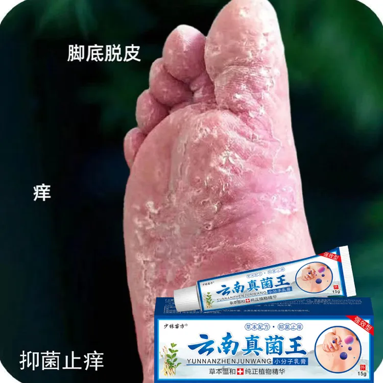 脚底板严重脱皮起皮开裂粗糙起小水炮草本抑菌止痒护理乳膏