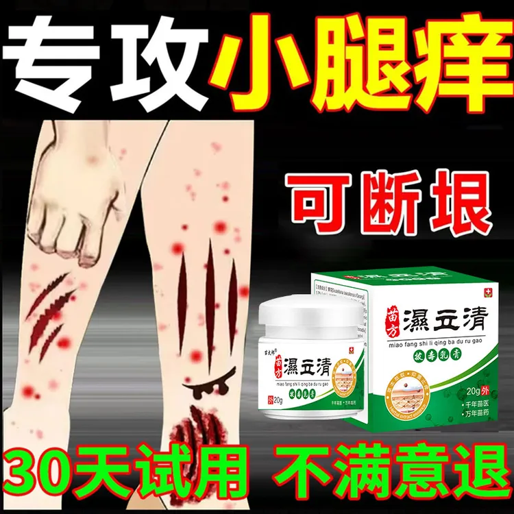 皮肤湿毒痒特效药腿干燥瘙痒湿痒止痒膏春夏越抓越痒出血起红疙瘩