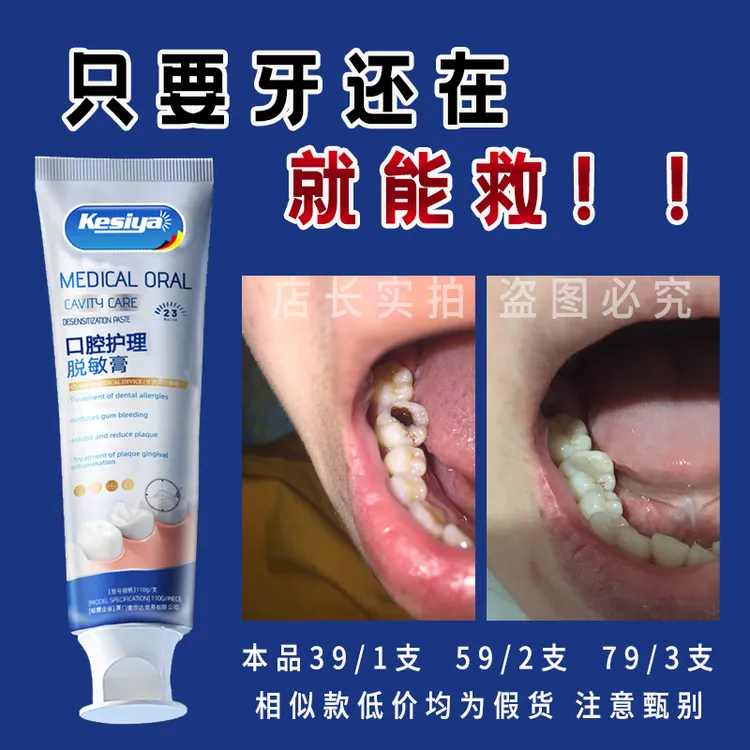 【牙膏界的佼佼者】德国牙膏牙黄牙黑敏感大牌护理牙膏