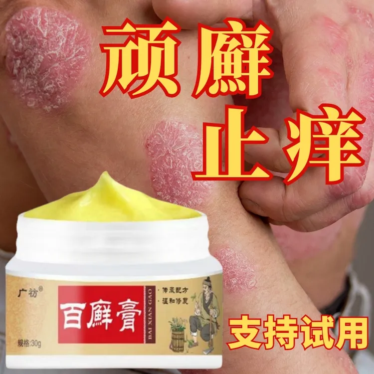 百廯膏全身牛/皮/银/屑痒手足头体股大腿根止痒抑菌膏药专用肤癣
