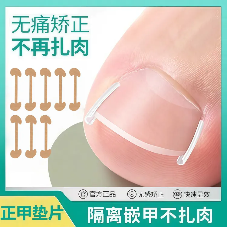 脚趾甲长肉里专用矫正器甲沟纠正嵌甲神器炎填充垫正甲贴修甲套装