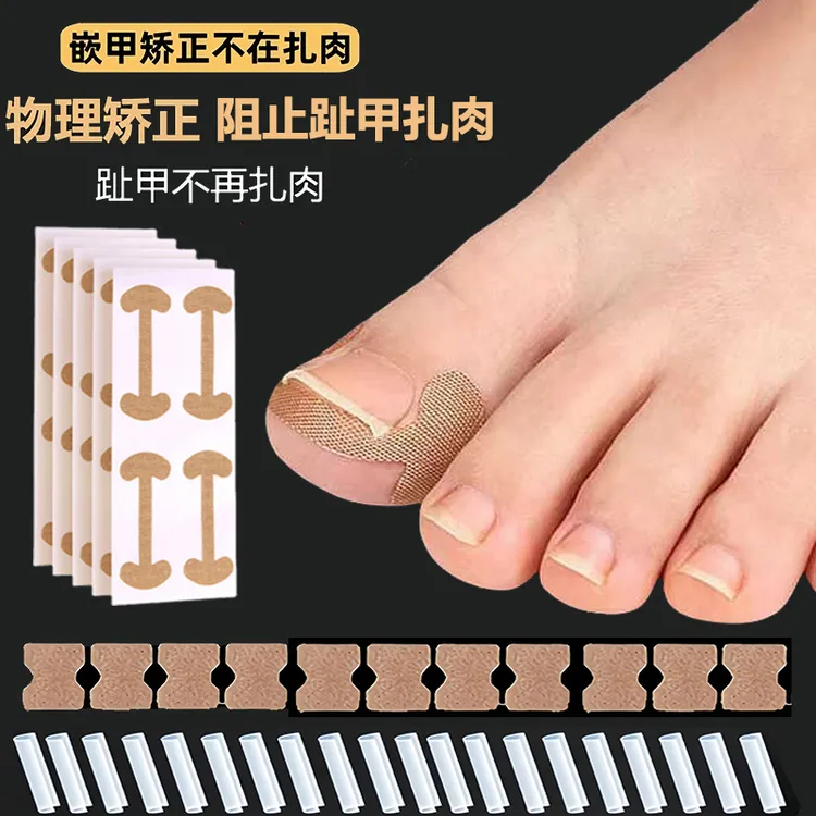 甲沟矫正神器嵌甲矫正贴片指甲往肉里长专用隔离纠正脚趾甲填充垫