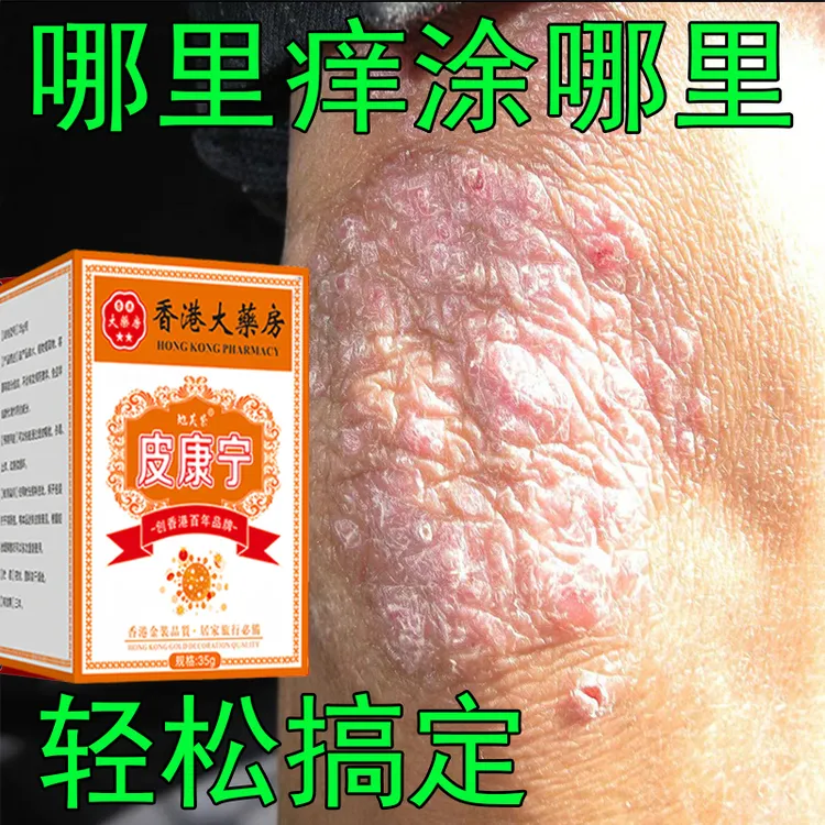 【香港皮康宁】牛皮肤银屑膏头藓顽固手足股止痒大腿内侧痒全身可用