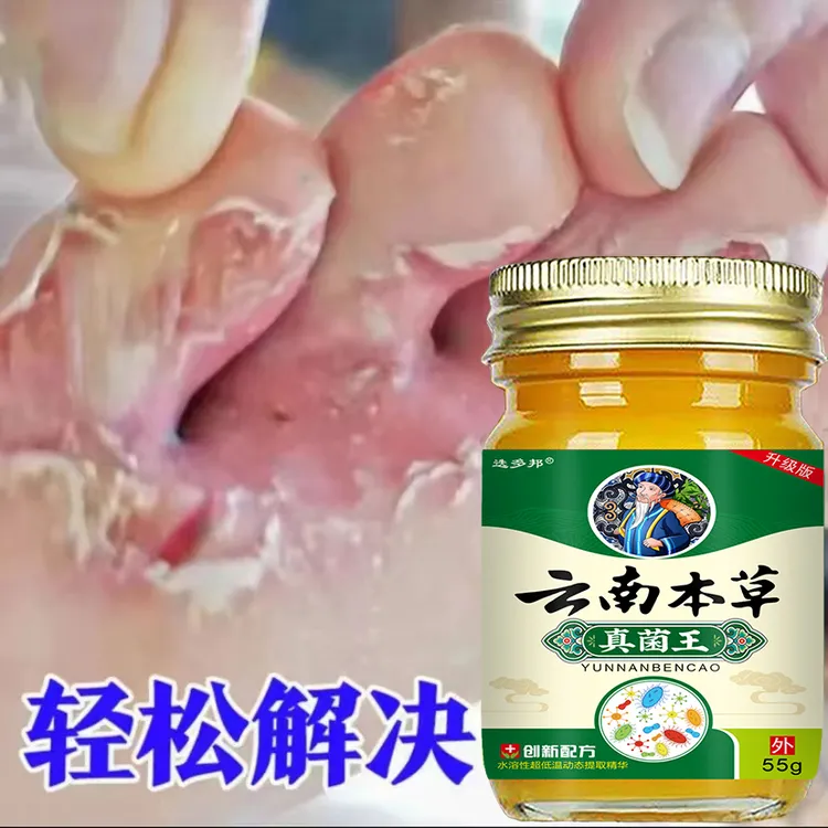 止痒膏去脚出汗起水炮干裂脚趾缝痒抑菌止痒神器真菌【足部护理】