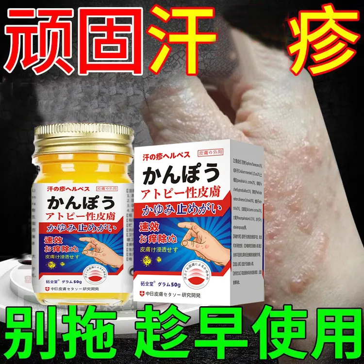 手指起小水泡很痒手脱皮干裂真菌手痒感染的克星汗珍专用止痒乳膏