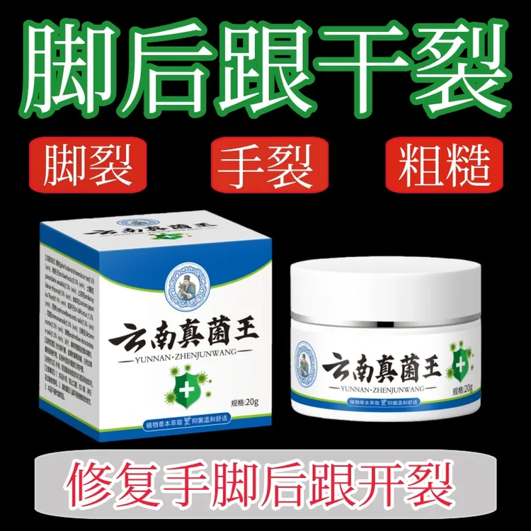 正品云南真菌王脚后跟起皮粗糙干裂起硬皮手开口干裂防裂膏