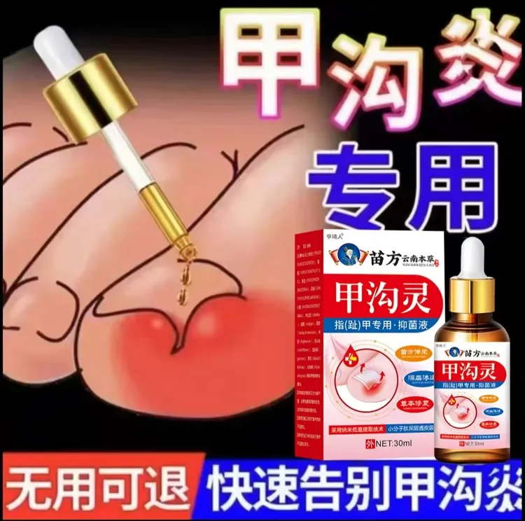 指甲长肉里甲沟软甲脱甲脚趾甲化脓嵌甲肉芽脚指头疼甲沟膏