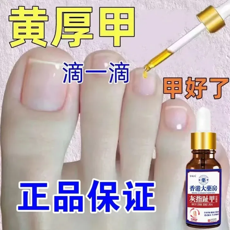 灰指趾甲灰脚指甲专用抑菌液特亮甲坏甲效趾甲复抑菌液