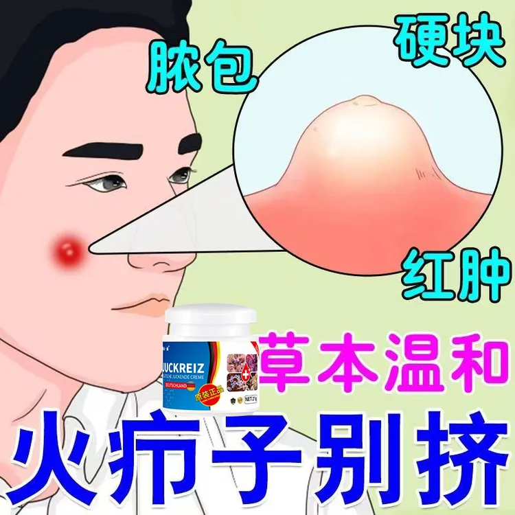 火疖子拔毒膏脸上硬块脓包红疙瘩坐板疮红肿疼皮肤瘙痒疖子拔脓膏
