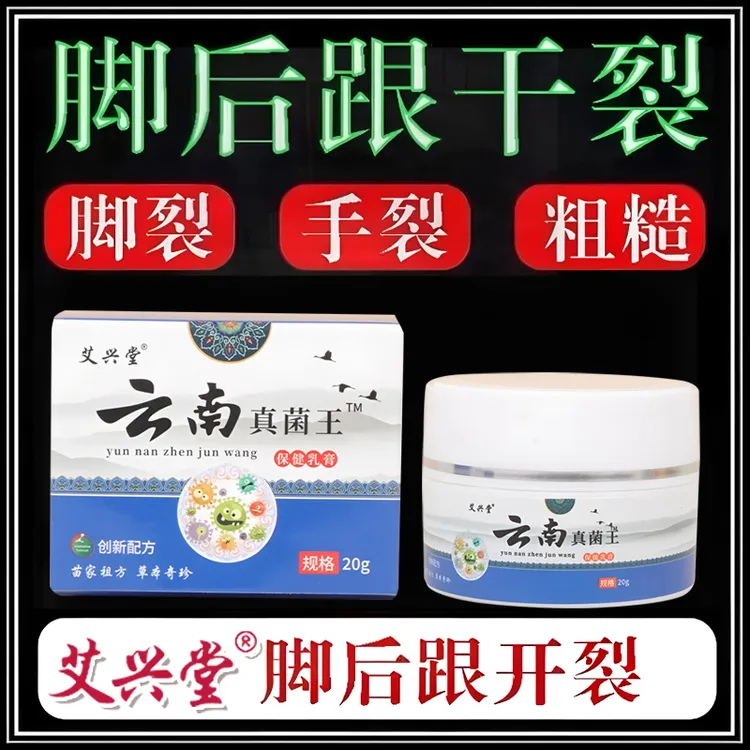 正品云南真菌王脚后跟起皮粗糙干裂起硬皮手开口干裂防裂膏