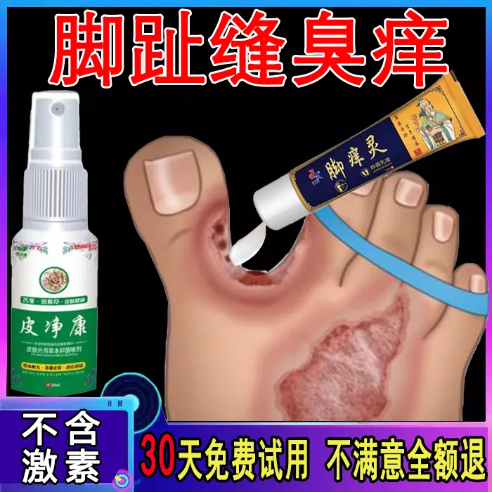 脚趾缝臭痒专用脚痒脚水泡脱皮真菌王脚抑菌神器开裂克星喷雾剂