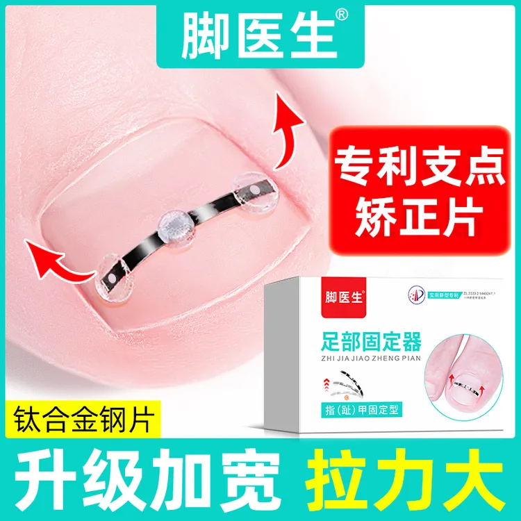 JIAOYISHENG/脚医生脚趾甲贴片辅助嵌甲甲沟炎矫正指甲专用正甲贴足部固定器