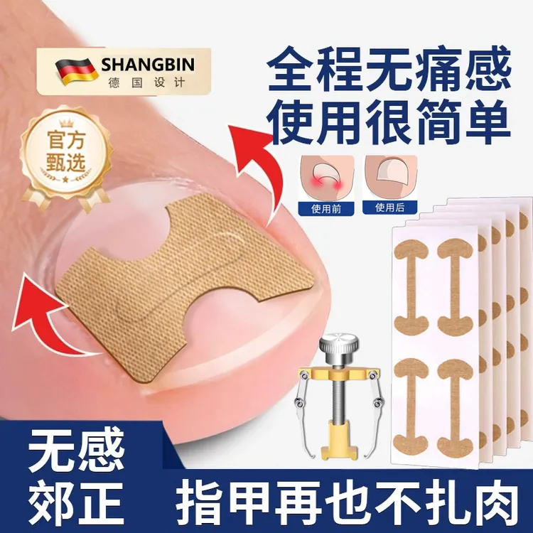 甲沟炎矫正神器正甲贴指甲扎肉嵌甲矫正器脚趾甲往肉里长隔离垫片