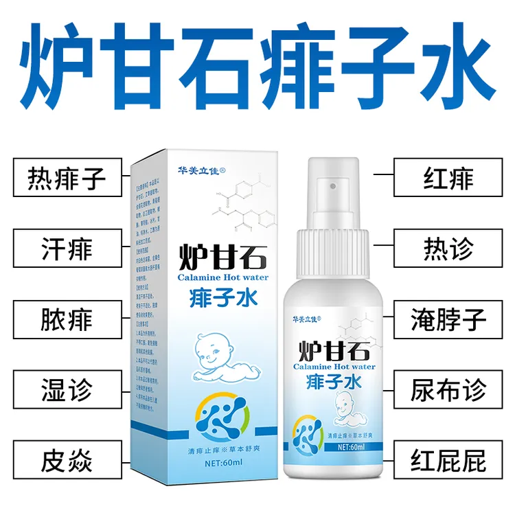 炉甘石痱子水成人婴幼儿童热痱子喷雾去痱子粉热疹止痒喷剂神器