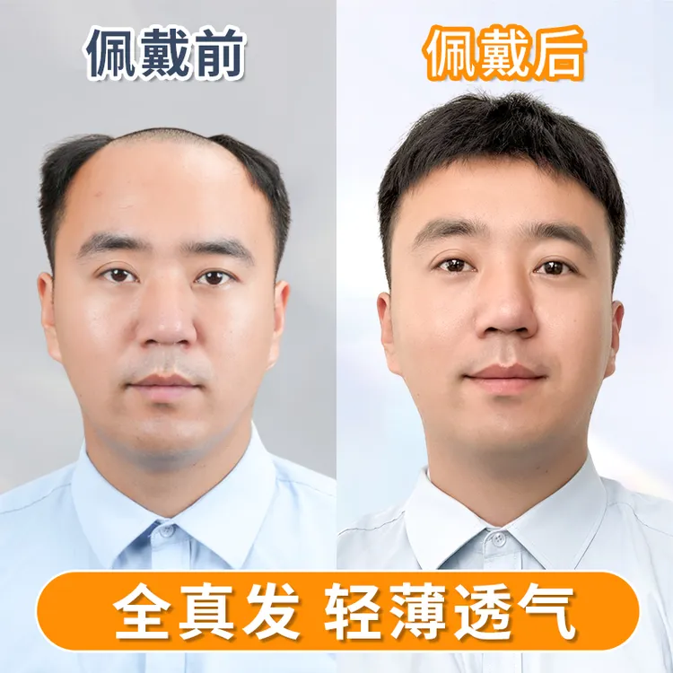 MIEAR·米尔头顶假发男士全真发手织遮秃补发高级假发高端补发片