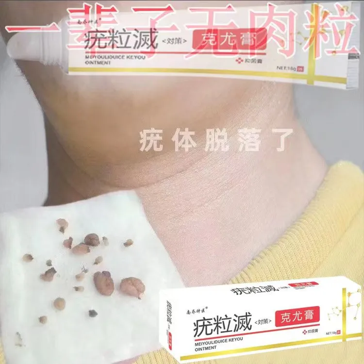 【小肉粒专用】正品云南白草克尤膏脖子手足腋下丝状扁平肉刺草本