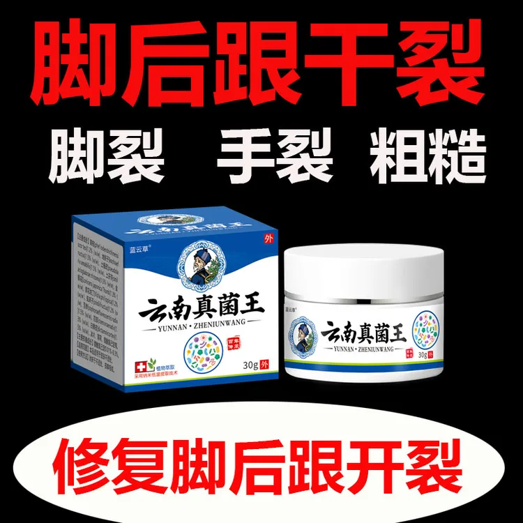 正品云南真菌王脚后跟起皮粗糙干裂起硬皮手开口干裂防裂膏