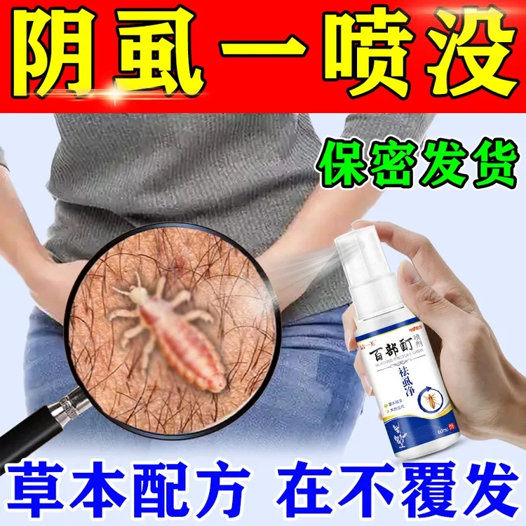 正品百部酊去虱子喷雾去虱子虱子卵头上下面男女通用虱立净喷剂