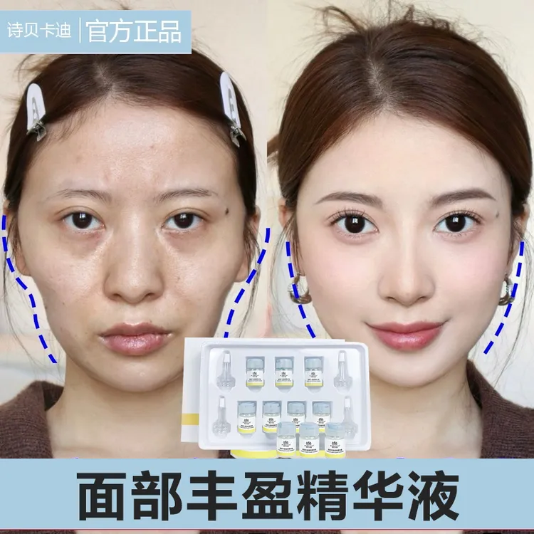面部丰盈植物精华液太阳穴泪沟法令纹面颊脸部圆润饱满自然正品