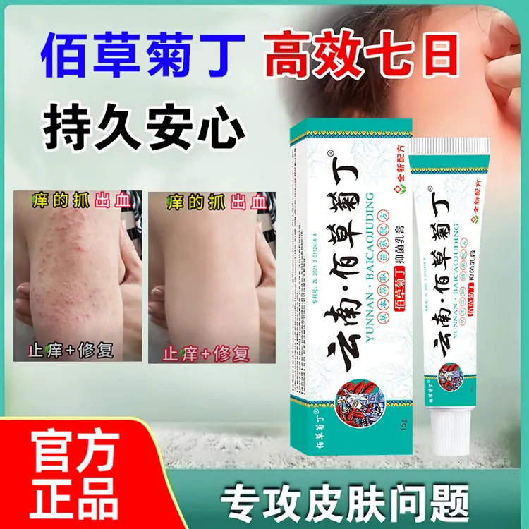 官方正品【云南佰草菊丁】大腿内侧瘙痒越抓越痒大腿止痒膏男去潮湿