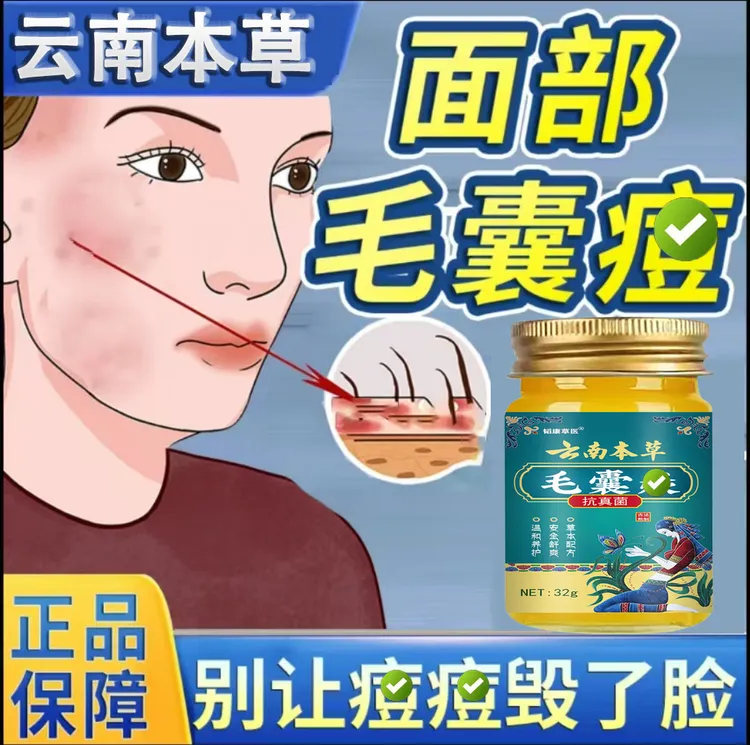 腮边痘下巴腮帮子脸颊两边脖子长痘温和舒缓肌肤抑菌止痒软膏外用