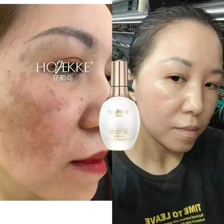 花肌可焕肌养颜修护露亮肤白皙改善色素去黄美容院正品发货